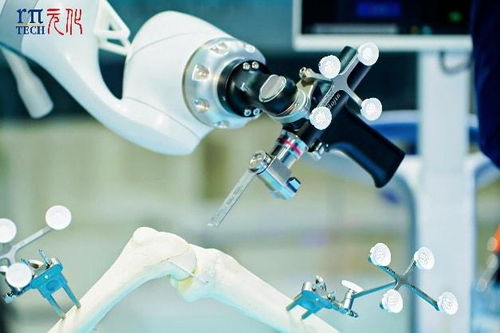 科技賦能醫(yī)療新未來 元化智能錕铻全骨科手術(shù)機(jī)器人閃耀進(jìn)博會(huì)